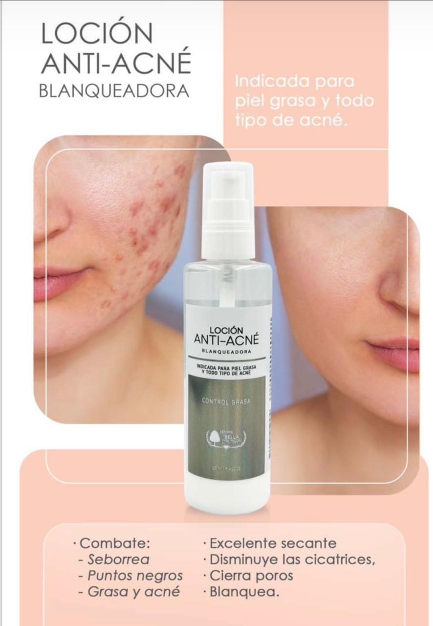 Leche anti-acné blanqueadora