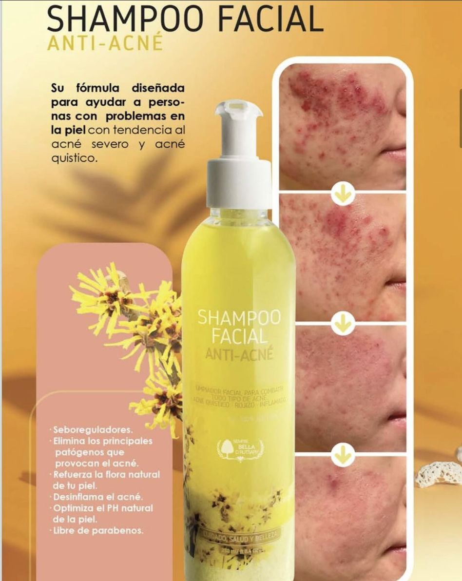 Shampoo facial anti-acné