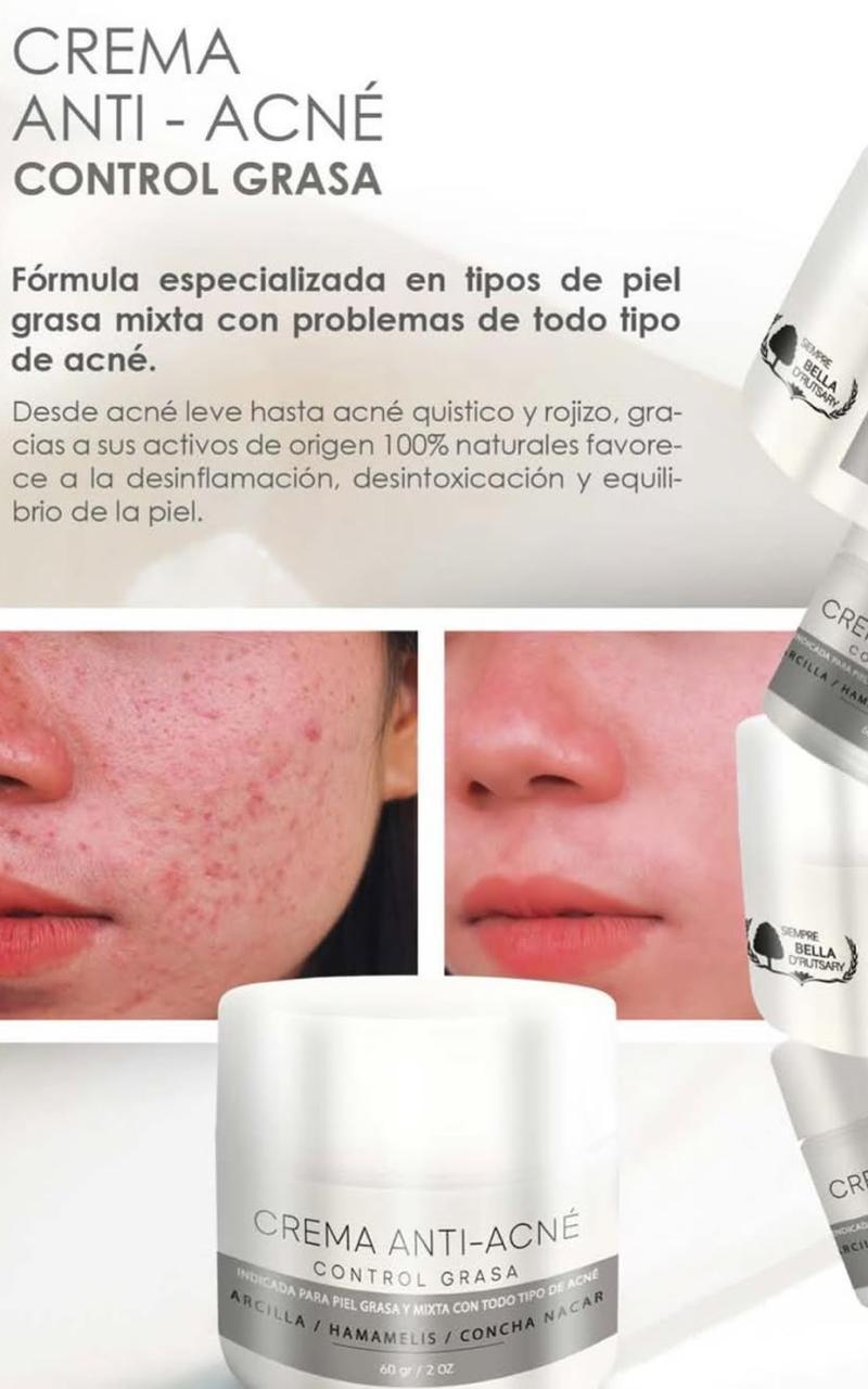 Crema anti-acné