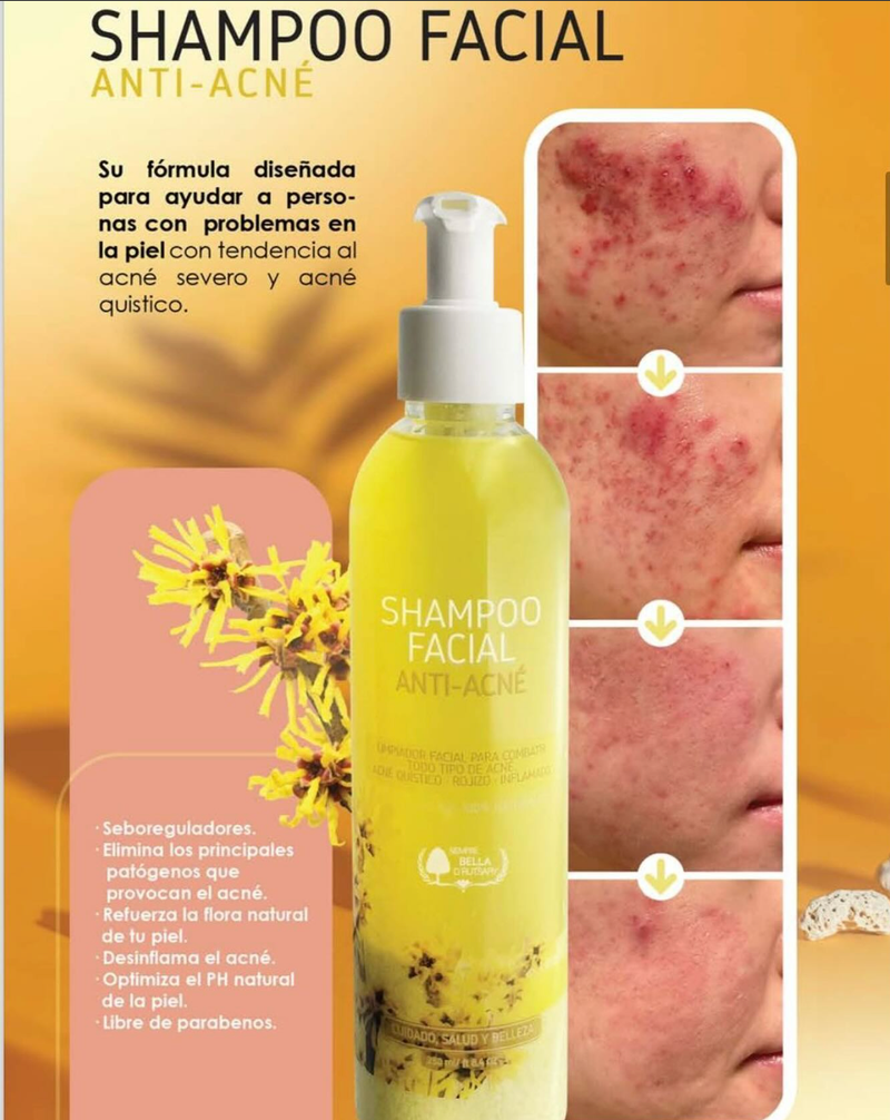 Shampoo facial anti-acné