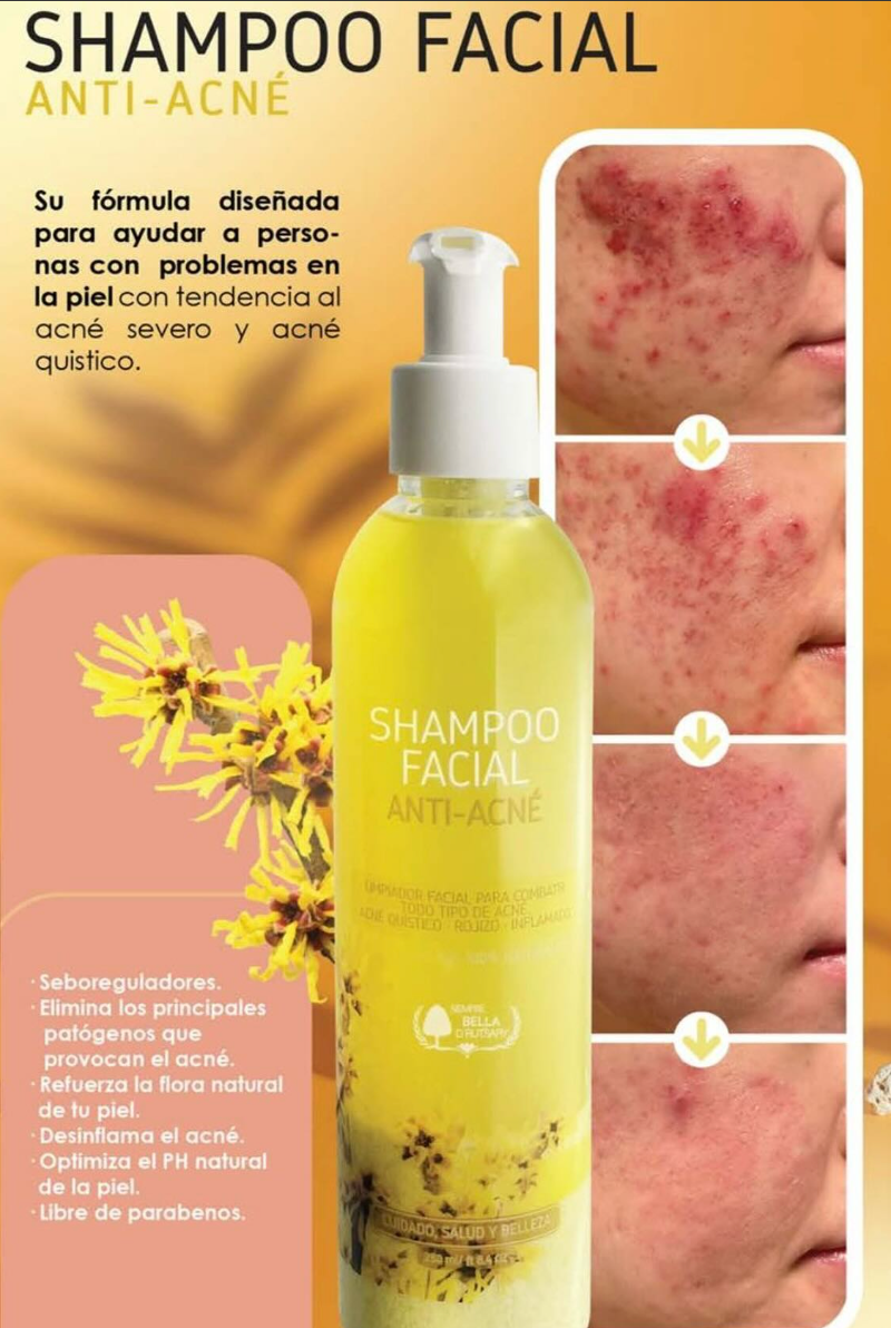Shampoo facial anti-acné